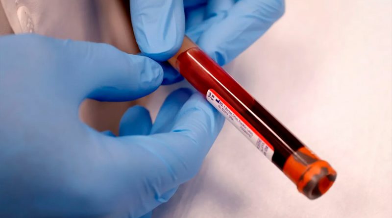 Una farmacéutica logra un nuevo anticuerpo que bloqueó al coronavirus en una prueba de laboratorio