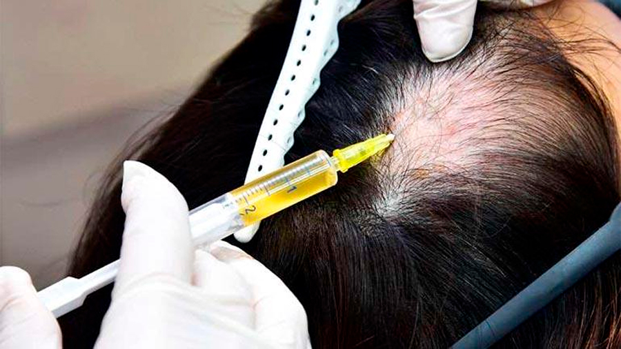 Un ensayo muestra la capacidad de células madre para hacer crecer el cabello