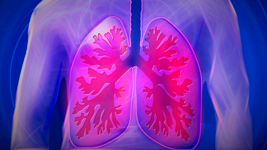 Células madre ralentizan la cicatrización pulmonar en la fibrosis pulmonar