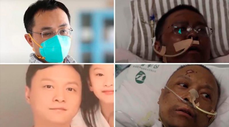Muere uno de los médicos chinos que despertó del Covid-19 con la piel negra