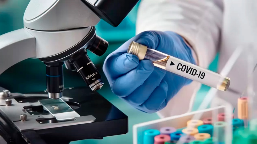 UNAM desarrolla prueba casera para detectar Covid-19 con potencial de producción masiva