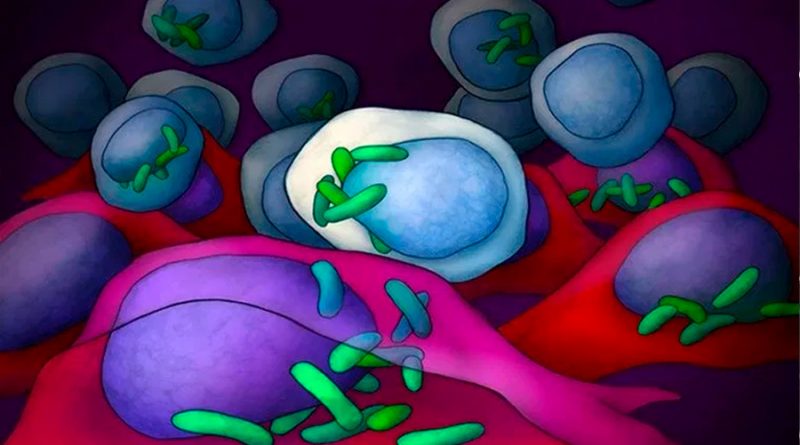 Encuentran bacterias que viven dentro de las células de todos los tipos de cáncer