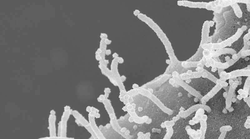 Las sorprendentes fotos de cómo ataca el coronavirus a las células humanas