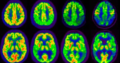 Revierten la pérdida de memoria del Alzheimer con una novedosa terapia génica