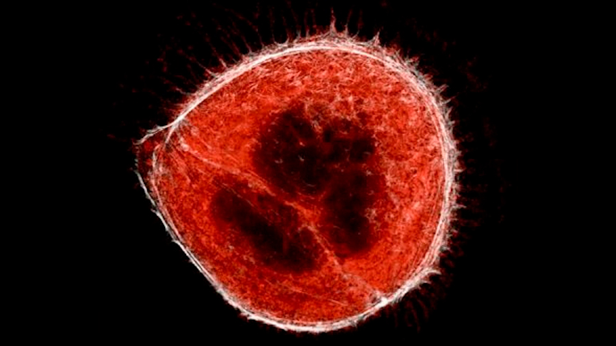 El coronavirus hace que algunas células desarrollen “tentáculos”, revelan imágenes