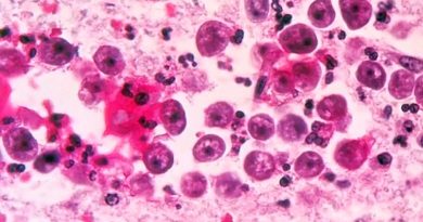 Ameba "comecerebros": Florida emite alerta de salud tras un raro caso de infección por el parásito