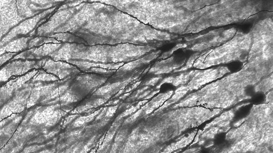 Se descubre una forma de regeneración excepcionalmente rápida en las neuronas lesionadas