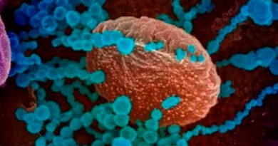 Descubren como el Coronavirus se camufla para entrar a las células sin que el sistema inmune lo detecte