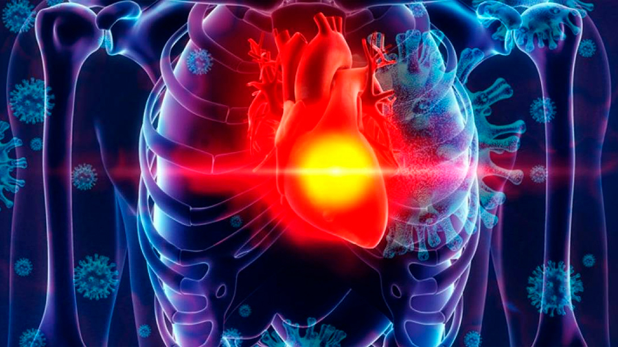 Estudio muestra que la mayoría de pacientes recuperados de Covid-19 quedaría con problemas cardíacos