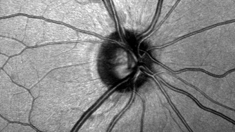Investigadores descubren células madre en el nervio óptico que podrían preservar la visión