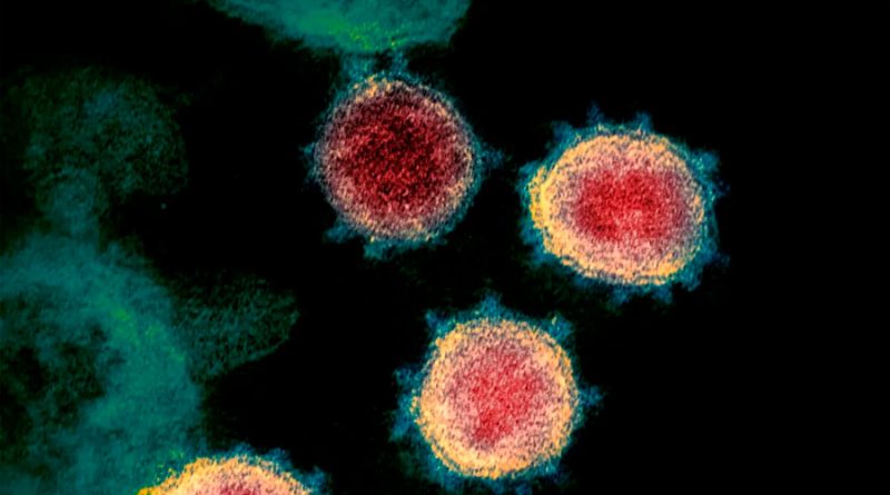Descubren una nueva 'debilidad' en el coronavirus: cómo evitar que se una a la célula huésped