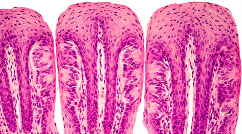 Identifican una nueva célula gustativa que detecta todos los sabores menos el salado