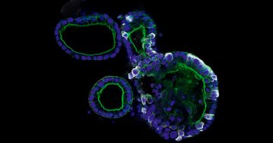 Los miniórganos revelan de qué modo el coronavirus hace estragos en el cuerpo