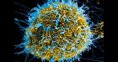 Hallan vía celular implicada en resistencia al ébola y al coronavirus