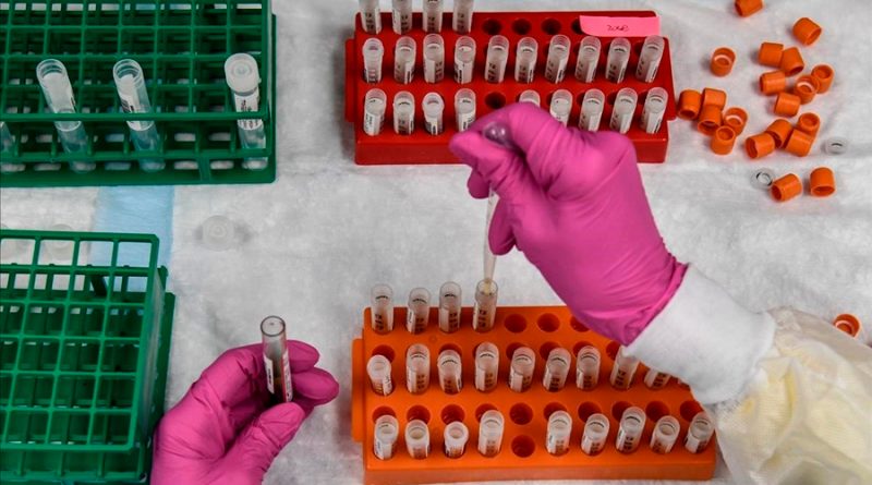 El proyecto de una vacuna casera contra el covid-19 crea alboroto entre los científicos