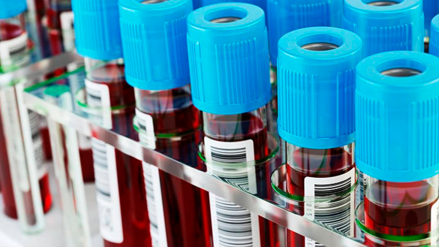 Un análisis de sangre detectaría cuáles son las personas con mayor o menor riesgo de morir por covid-19