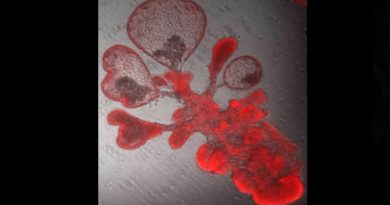 Modelos de “minipulmones” humanos dan respuestas sobre la infección por covid-19 en el tejido pulmonar