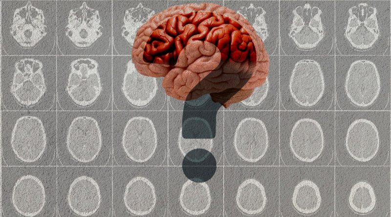Descubren una nueva y rara forma genética de demencia