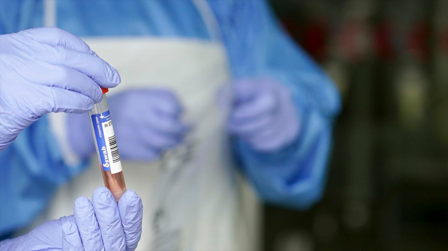 Un estudio de expertos apunta que la inmunidad contra el coronavirus podría durar toda la vida