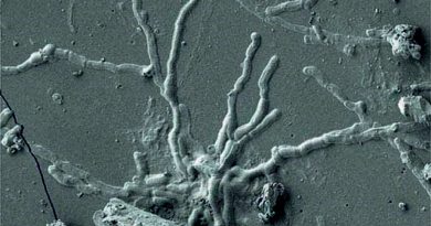 Científicos descubren neuronas vitrificadas de una víctima del Vesubio hace 2,000 años