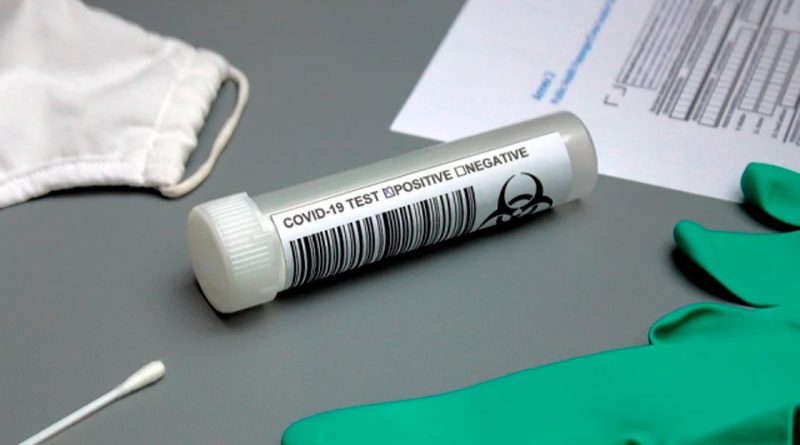 Desarrollan nuevo test capaz de detectar el coronavirus en 5 minutos