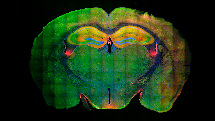 Descubren el mecanismo molecular que graba nuestros recuerdos en el cerebro