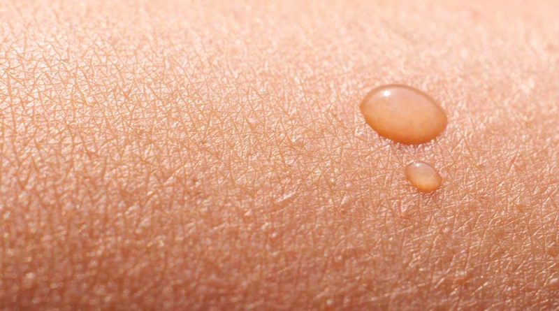 Investigadores logran regenerar la piel de un adulto para minimizar las cicatrices y combatir el envejecimiento