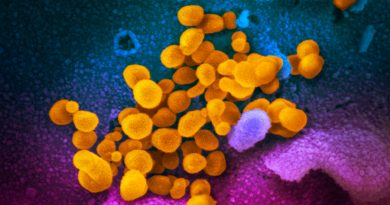 Científicos generan un clon infectivo del SARS-CoV-2 para estudiar su biología molecular