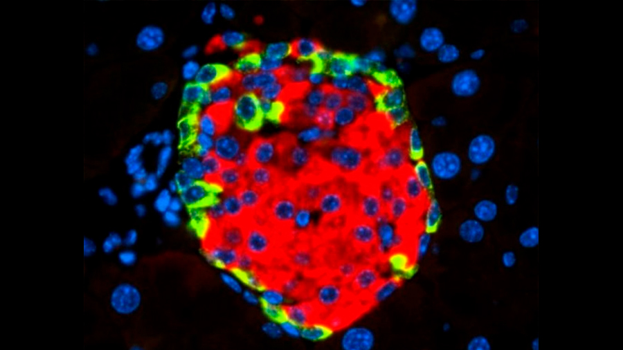 Describen cómo un virus puede causar diabetes