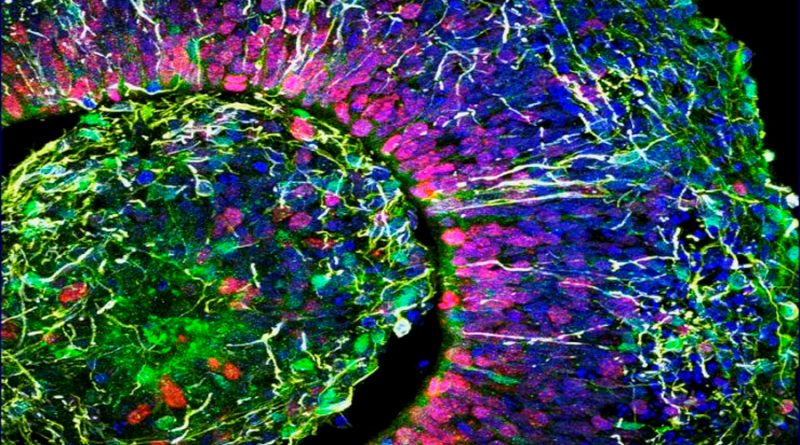 Mini cerebros creados en laboratorio con células madre humanas pueden generar un sistema cognitivo