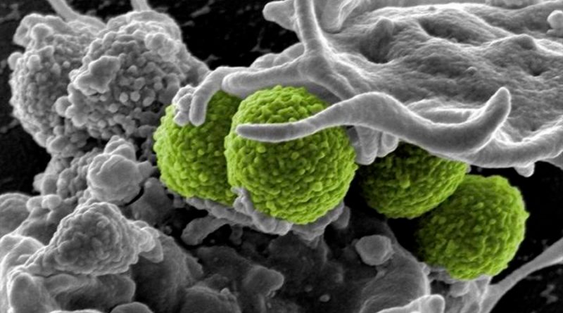 Descubren el secreto de la virulencia de las superbacterias en las infecciones diabéticas