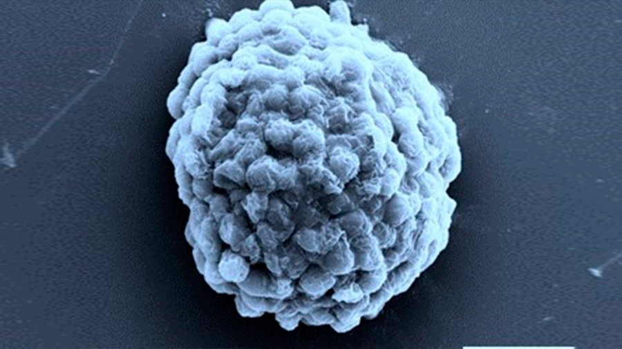 Logran hidrógeno combustible por fotosíntesis hecho en fábricas microbianas