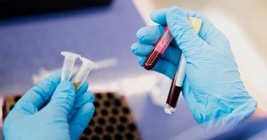 Un análisis de sangre que detecta 50 tipos de cáncer ya está en prueba