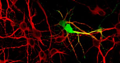 Reducen las moléculas que matan las neuronas en ratones con alzhéimer avanzado