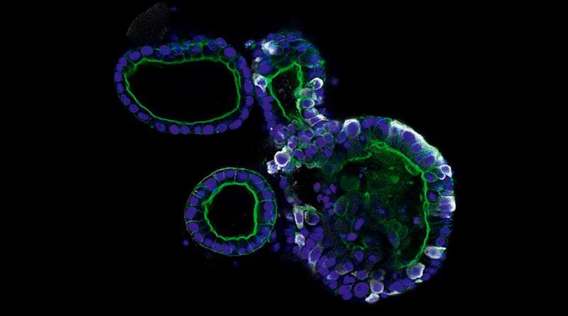 Miniórganos revelan de qué modo el coronavirus hace estragos en el cuerpo