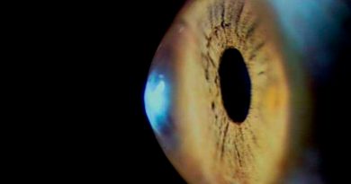 Científicos dan un paso importante hacia el uso de trasplantes de células de retina para tratar la ceguera