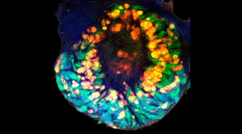 Crean minirriñones vascularizados a partir de células madre humanas