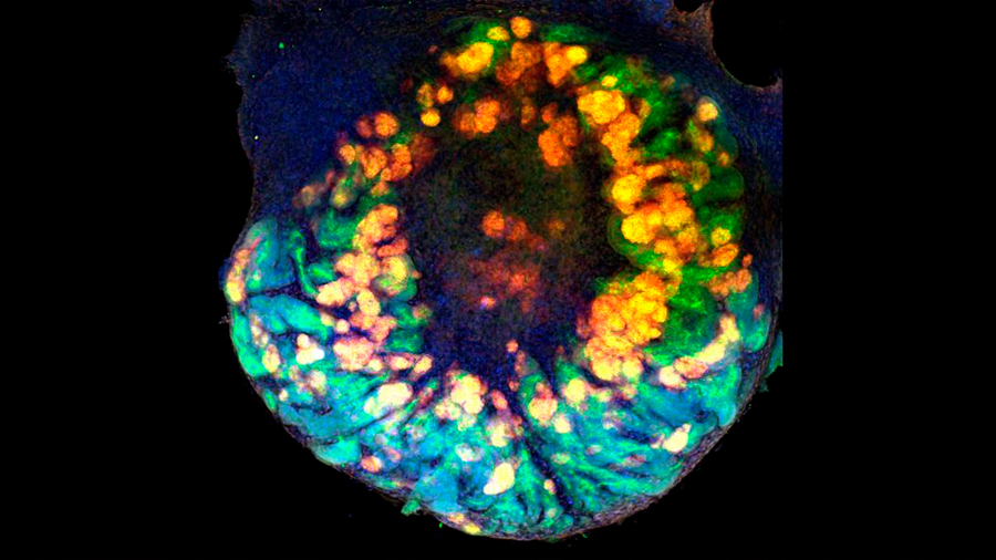 Crean minirriñones vascularizados a partir de células madre humanas