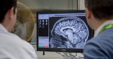 Hallan las células cerebrales más vulnerables al Alzheimer