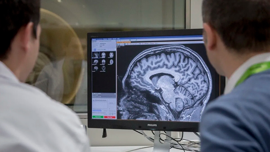 Hallan las células cerebrales más vulnerables al Alzheimer