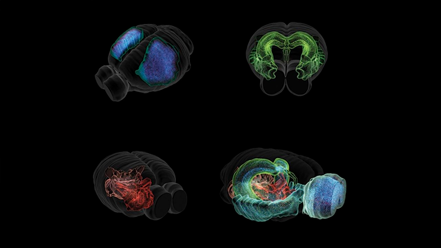 Crean un 'mapa de Google' molecular del cerebro