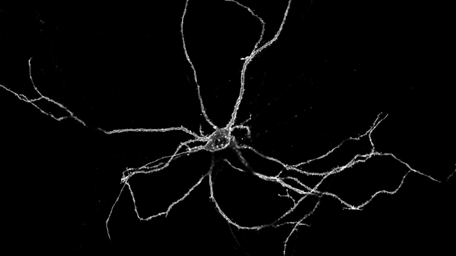 Un zoom sobre las neuronas descubre una cadena cerebral de luces