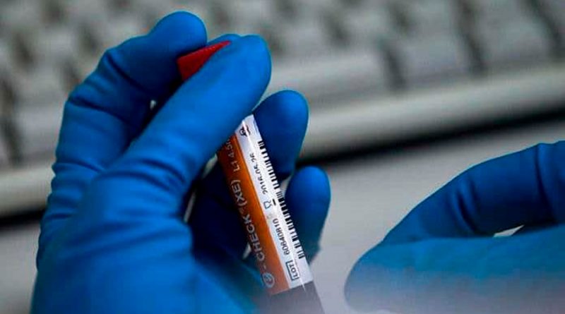 Científicos de la UNAM desarrollan pruebas en sangre para cáncer de pulmón
