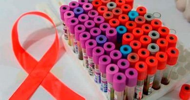 Células "asesinas" activadas por nanopartículas ayudan a eliminar el VIH