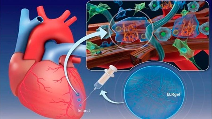 Crean un hidrogel que regenera el tejido cardíaco tras un infarto