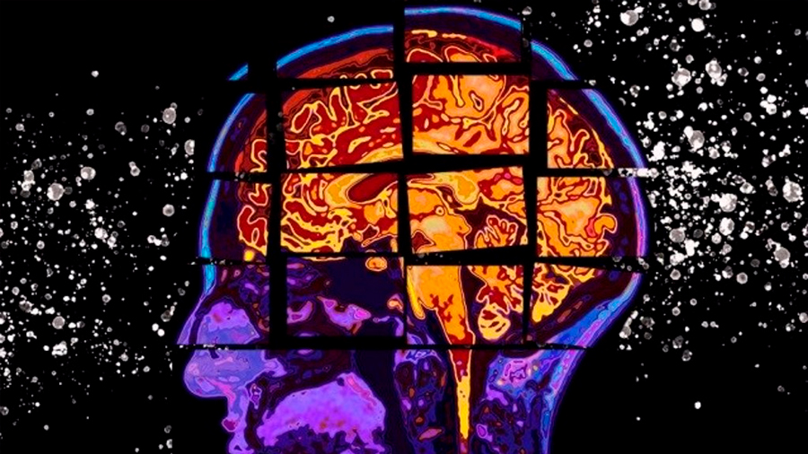 Crean una IA que identifica fármacos ya aprobados que pueden ser útiles contra el Alzheimer