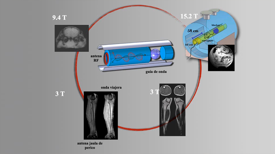 Diseñan en la UNAM nueva tecnología para lograr mejores imágenes por resonancia magnética