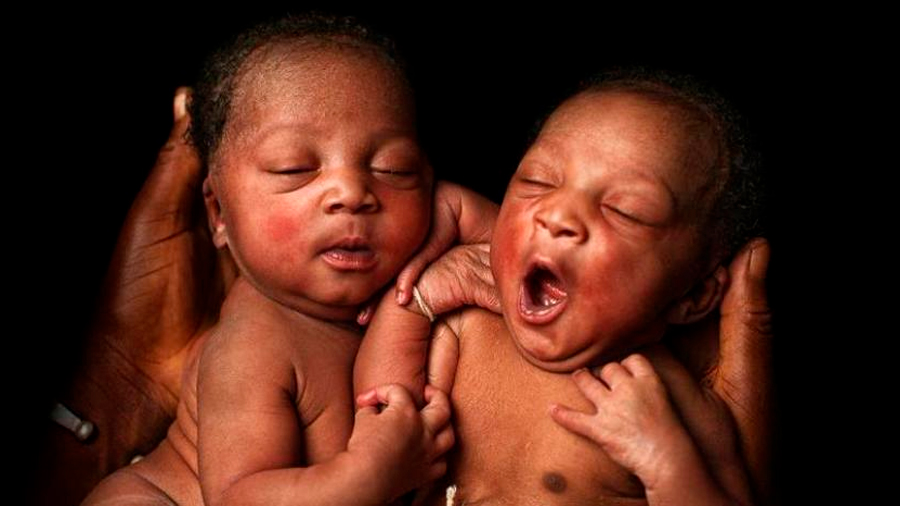 Los nacimientos de gemelos llegan a un máximo mundial