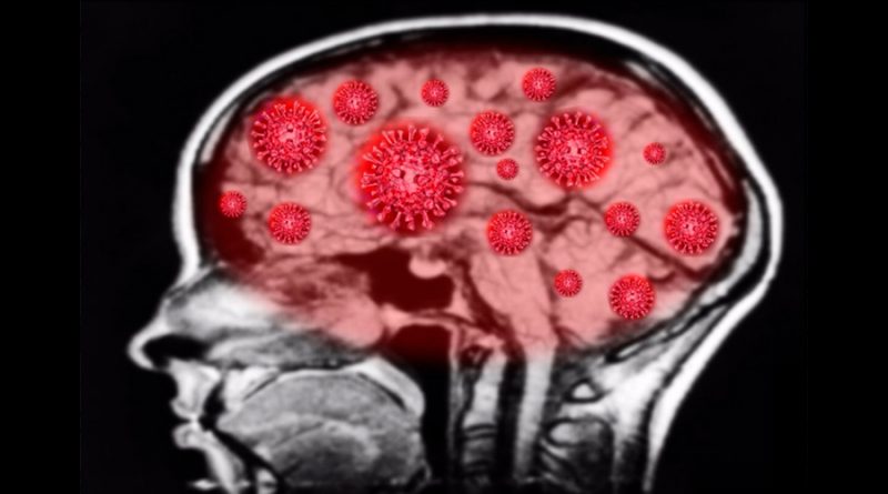 Descubren científicos que el Covid-19 no infecta el cerebro... pero causa daños neurológicos