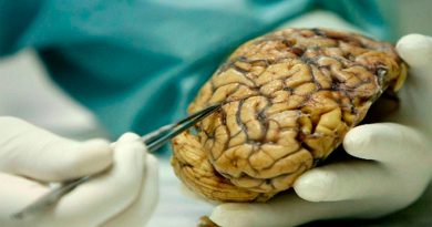 Covid-19 reduce el volumen de materia gris en el cerebro, según estudio